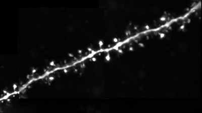 万博在线客服A_Spike-timing_depnedent_plasticity_rule_for_dentritic_spines_teaser-BRUKER
