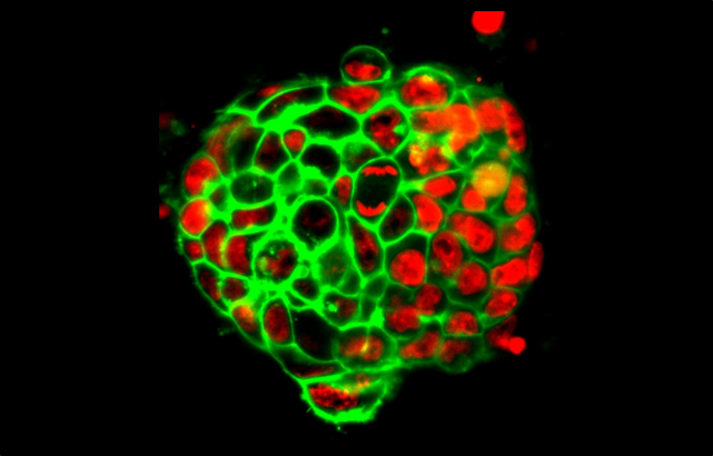 由轻型显微镜成像的小鼠胚胎干细胞的菌落