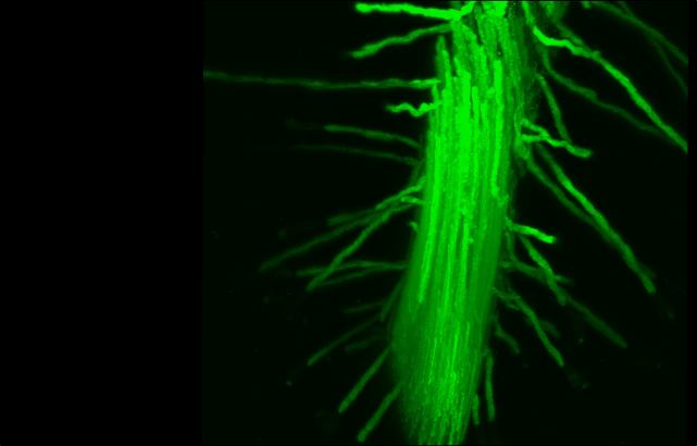 转基因拟南芥根系从轻薄显微镜表达膜标记的图像。