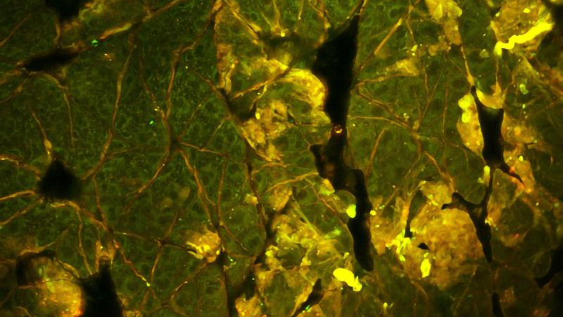 小鼠上皮的高分辨率双光子激发荧光强度图像。内在NADH荧光为绿色，角蛋白自身荧光为红色/黄色。