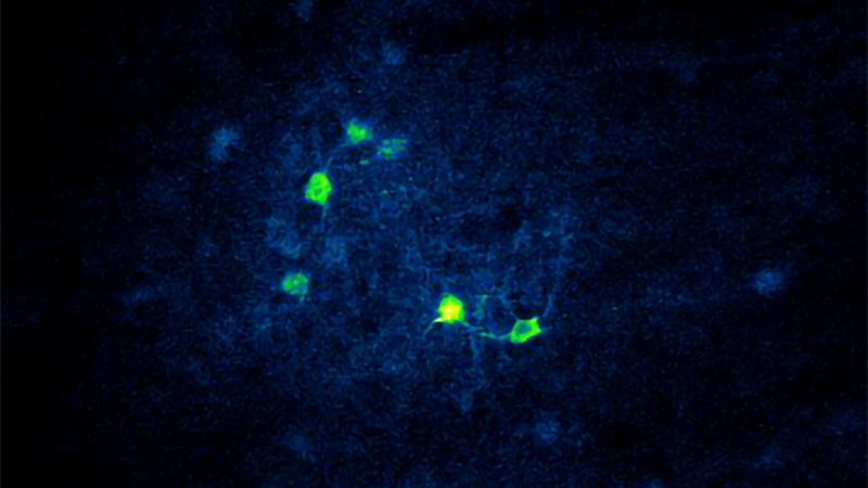 全息光电刺激用Newuralight 3D（SLM）的神经元表达GCAMP6和CHRMINE INC到4.2 mm胶层镜片。