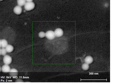 SE图像过滤物上硅纳米粒子