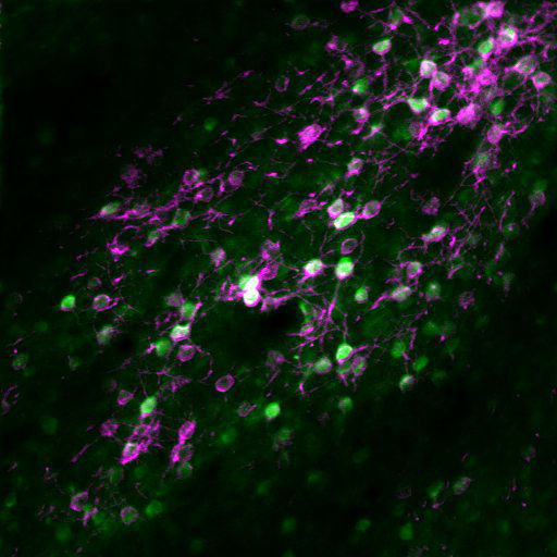 小鼠视觉皮质5A层神经元中GCaMP6s与体细胞限制C1V1-mRuby2的共表达