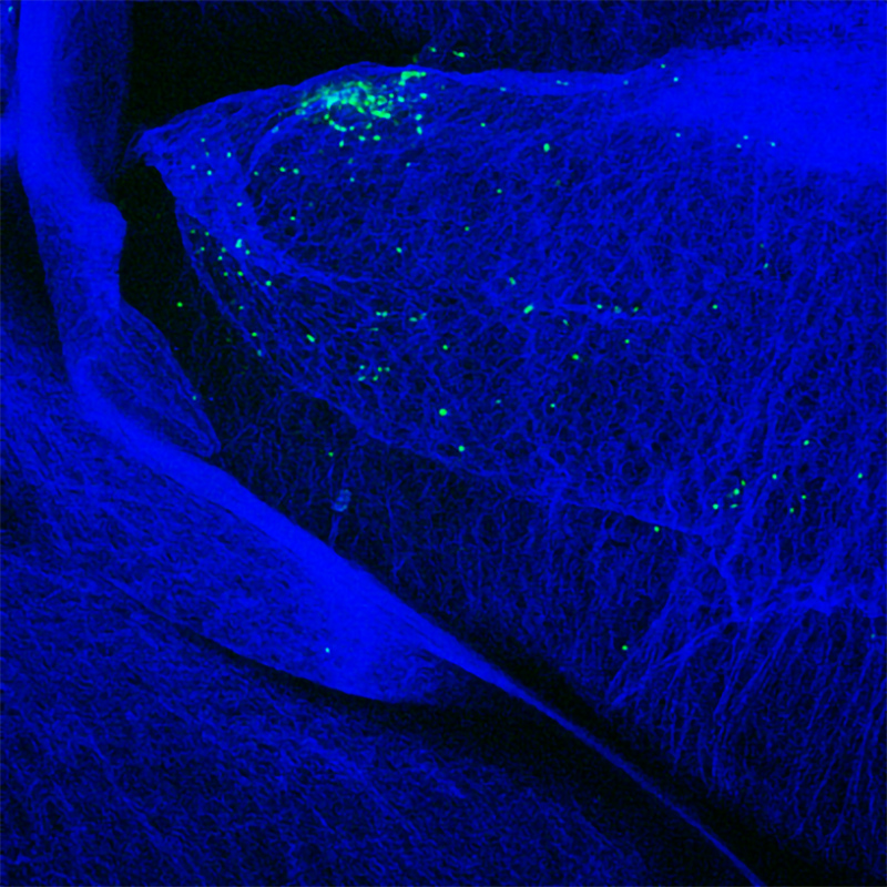 表达gfp的T细胞(绿色)在小鼠胰岛周围聚集，发展为自身免疫性胰腺炎，最终导致糖尿病。