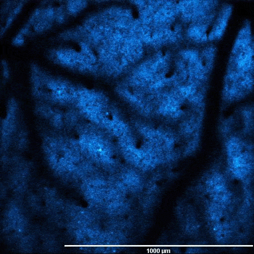 在转基因小鼠中表达GCAMP6的神经元的自发荧光波动