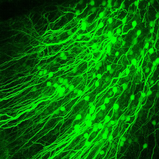 体栈三维视图，小鼠视觉皮层5B层神经元在体，用tdTomato标记(绿色)，标尺100µm