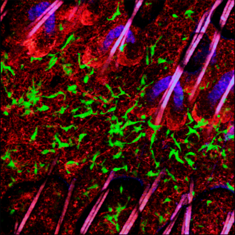 小鼠皮肤中表达egfp的树突状表皮T细胞(绿色)。静脉注射罗丹明6G划定真皮-表皮边界(红色)。由皮脂腺(蓝色自体荧光)显示，毛干(紫色)位于毛囊内。